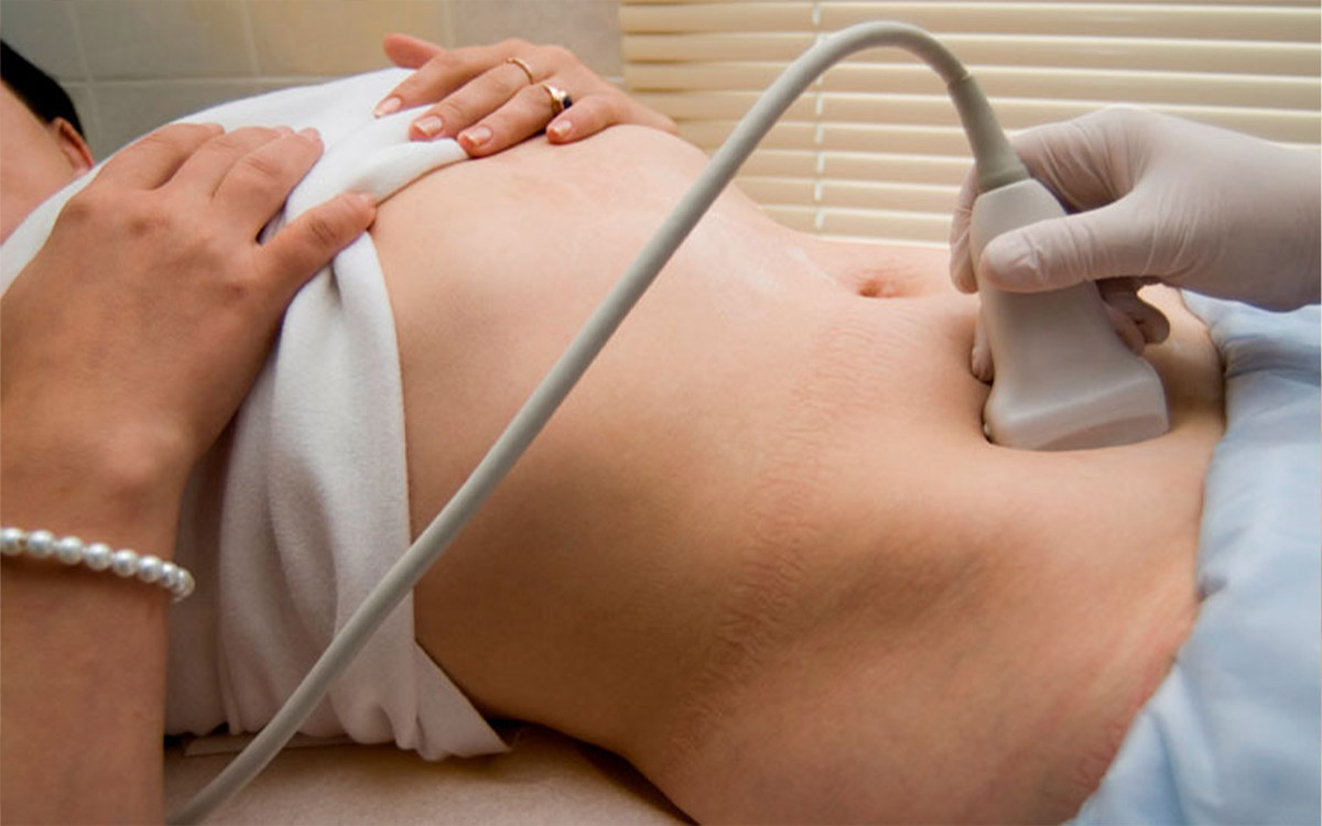 Pelvik Konjesyon Sendromu Tanı Yöntemleri